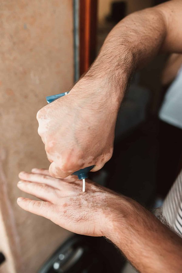Comment gérer les effets secondaires cutanés des thérapies ciblées pour le cancer?